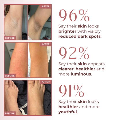 BODY PEEL SHOT 99% Pure Kojic Acid + Turmeric