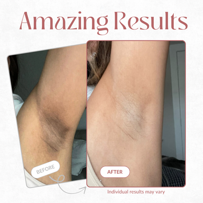 BODY PEEL SHOT 99% Pure Kojic Acid + Turmeric